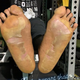 Image for article titled Antonio Brown's Feet Are A Nightmare